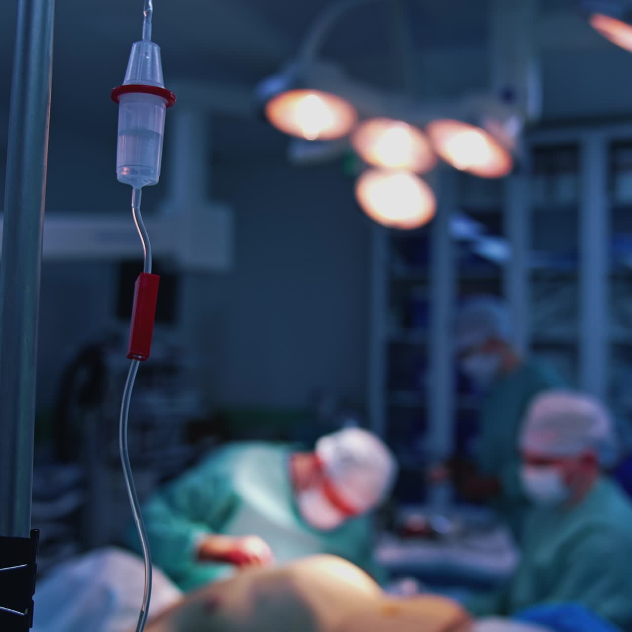 Contagocce su sfondo sfocato di un intervento chirurgico. Il medicinale gocciola lentamente da un contagocce medico durante un'operazione in sala operatoria. Chirurgia plastica.