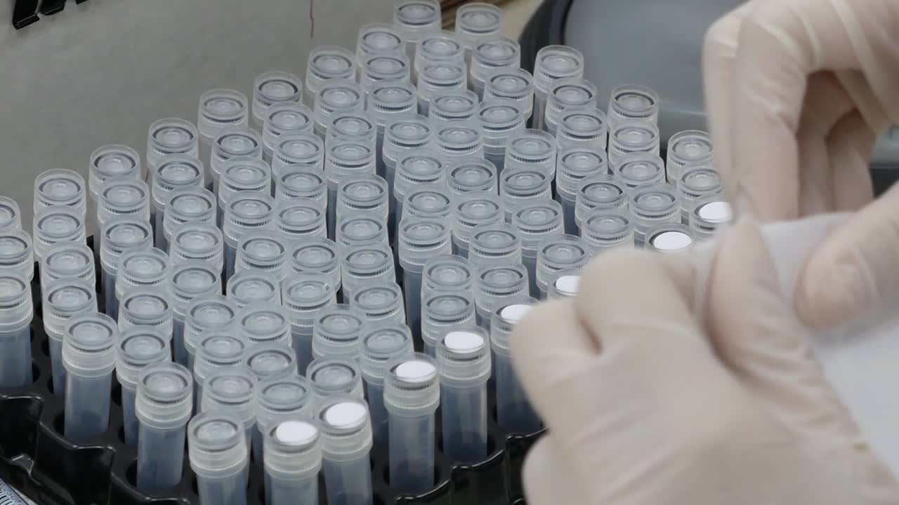 손잡이를 착용하여 주제 튜브에 라벨을 붙입니다.