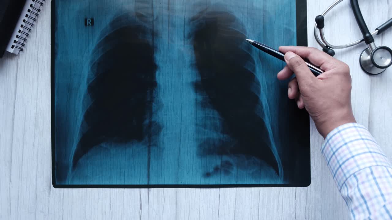 examen de rayos x en el pecho