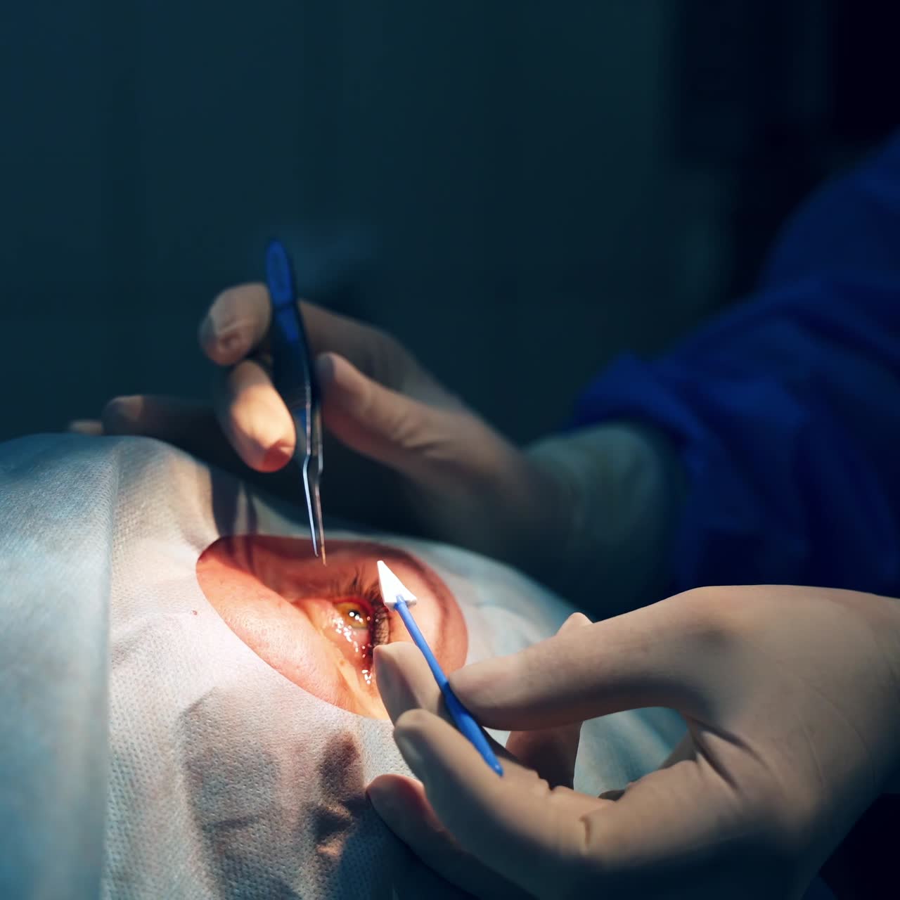 Patient under sterile cover