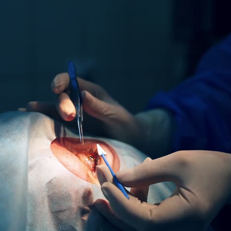 patient under sterile cover