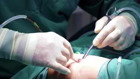 a surgeon's precision: intricate surgical procedure demonstrating detailed techniques and instruments in a controlled medical environment