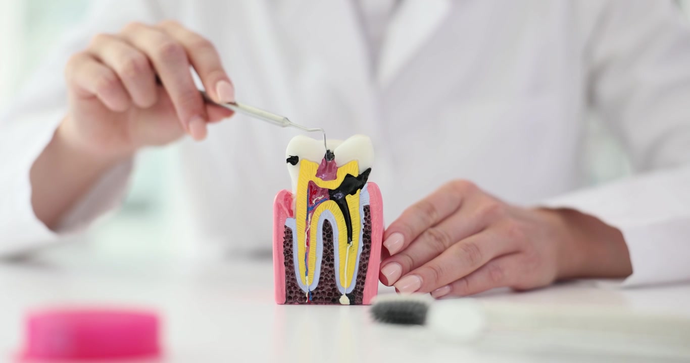 Dentista Mulher Mostra Dente Humano com Modelo Anatômico de Cárie