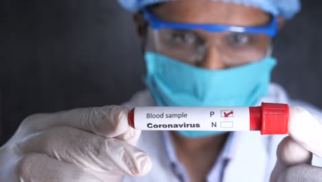 coronavirus blood sample test