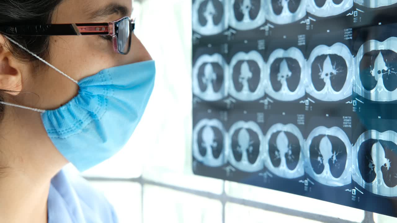 donna medico che esamina tomografia toracica, scansione tac a raggi x di malattie polmonari