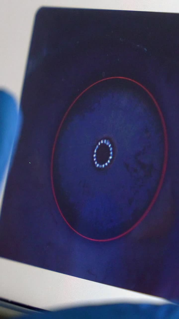 Eye and Iris Scanning Technology