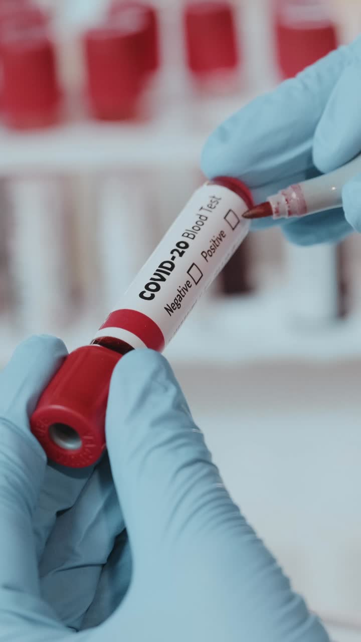 un profesional de la salud realiza un análisis de sangre para la covid-20 en un laboratorio clínico