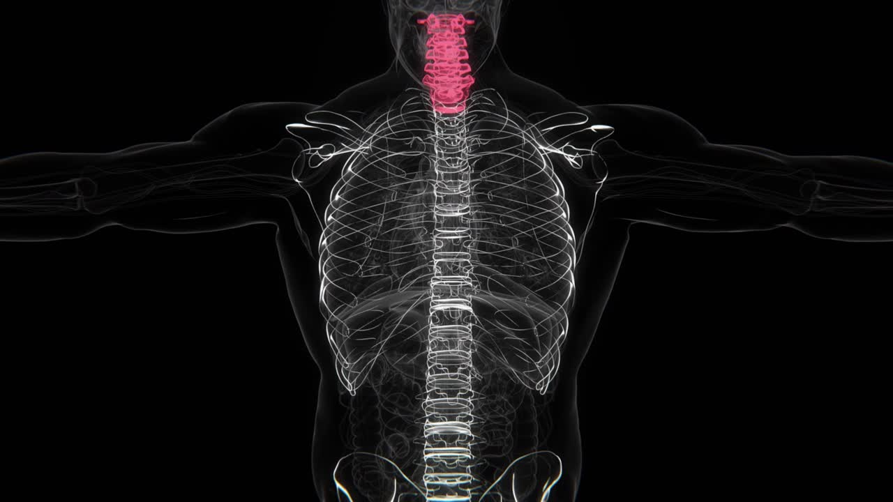 Indicación de espondilitis anquilosante en video de rayos X en HD | Video en HD de rayos X de columna con espondilosis