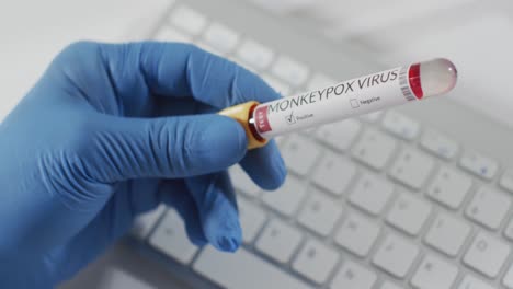 hand of doctor holding vial with monkeypox virus over keyboard