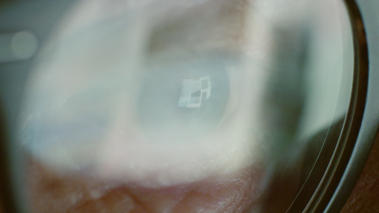 ⁇ , 안경과 눈 반사