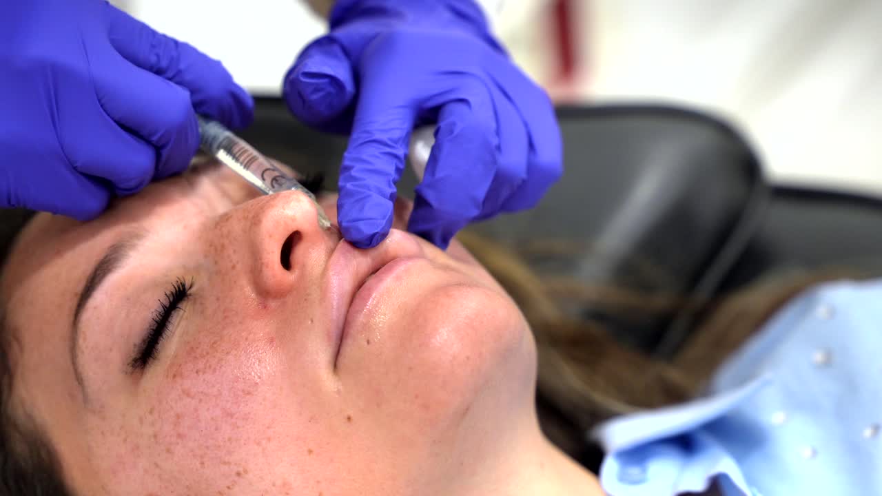 Lip Filler Injection Procedure