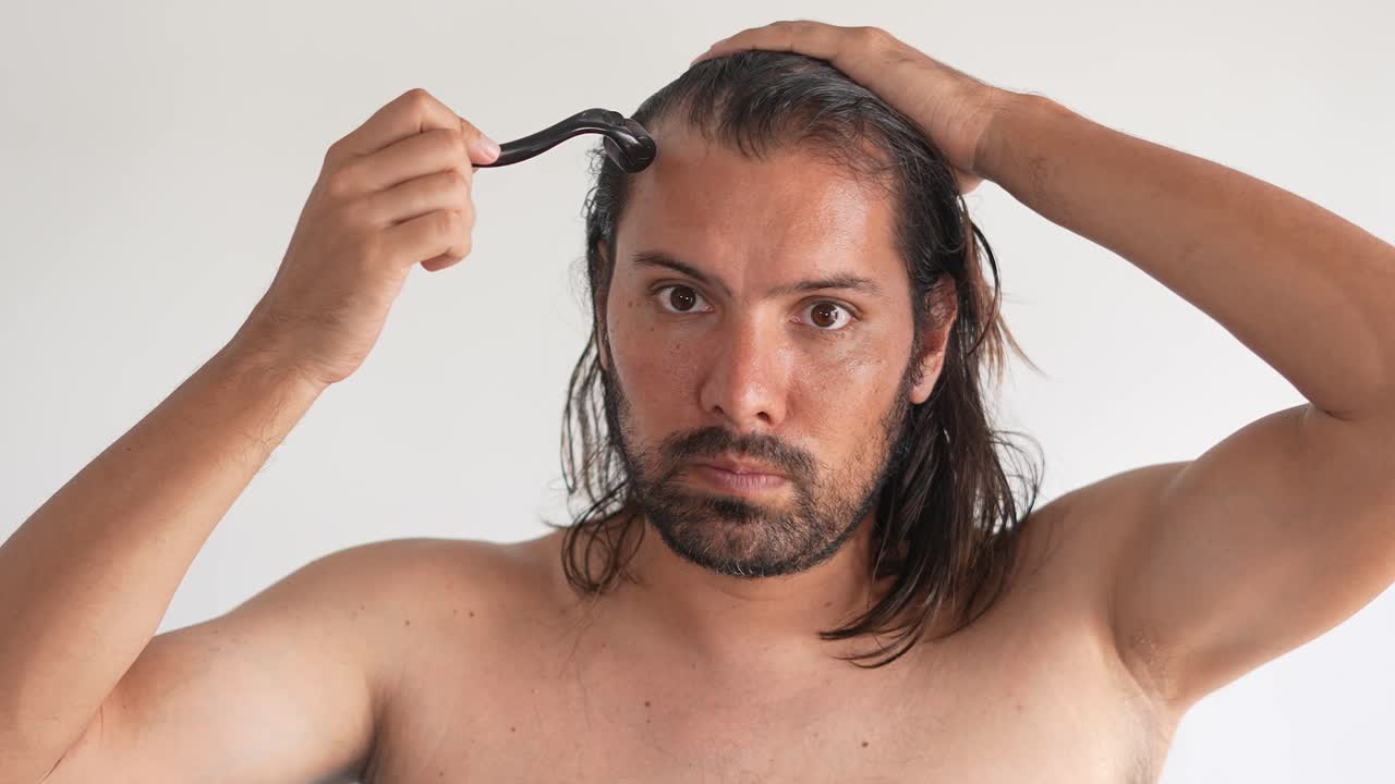 Man using a dermaroller on his scalp for hair care