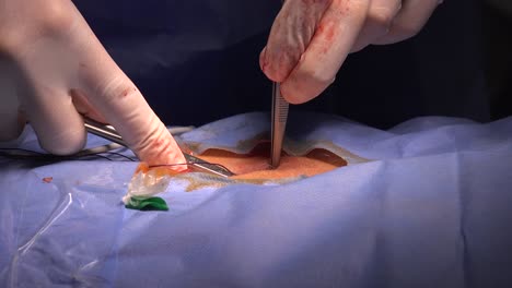 Surgical-suture-is-a-medical-device-used-to-hold-body-tissues-together-after-an-injury-or-surgery