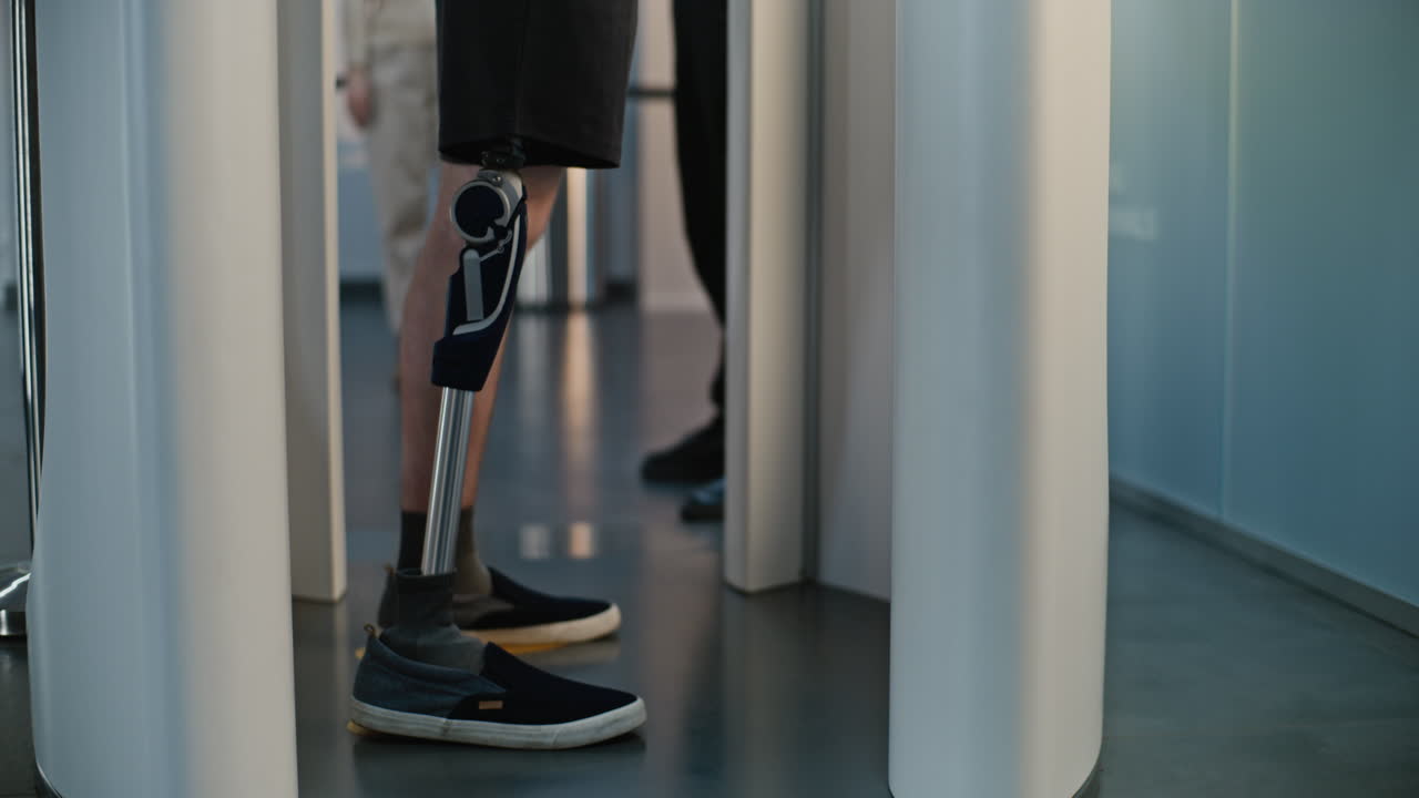 Person with Prosthetic Leg at Security Check