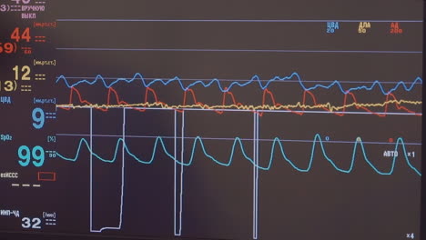 cardiac monitor data in surgery room closeup. digital technology controlling patient life indicators during coronary artery bypass surgery. computer screen