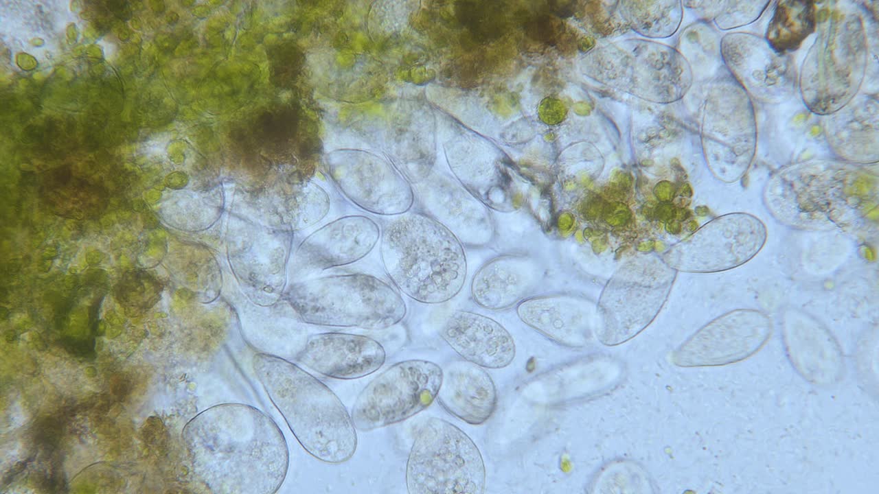 현미경 밝은 분야에서 paramecium 고밀도 인구