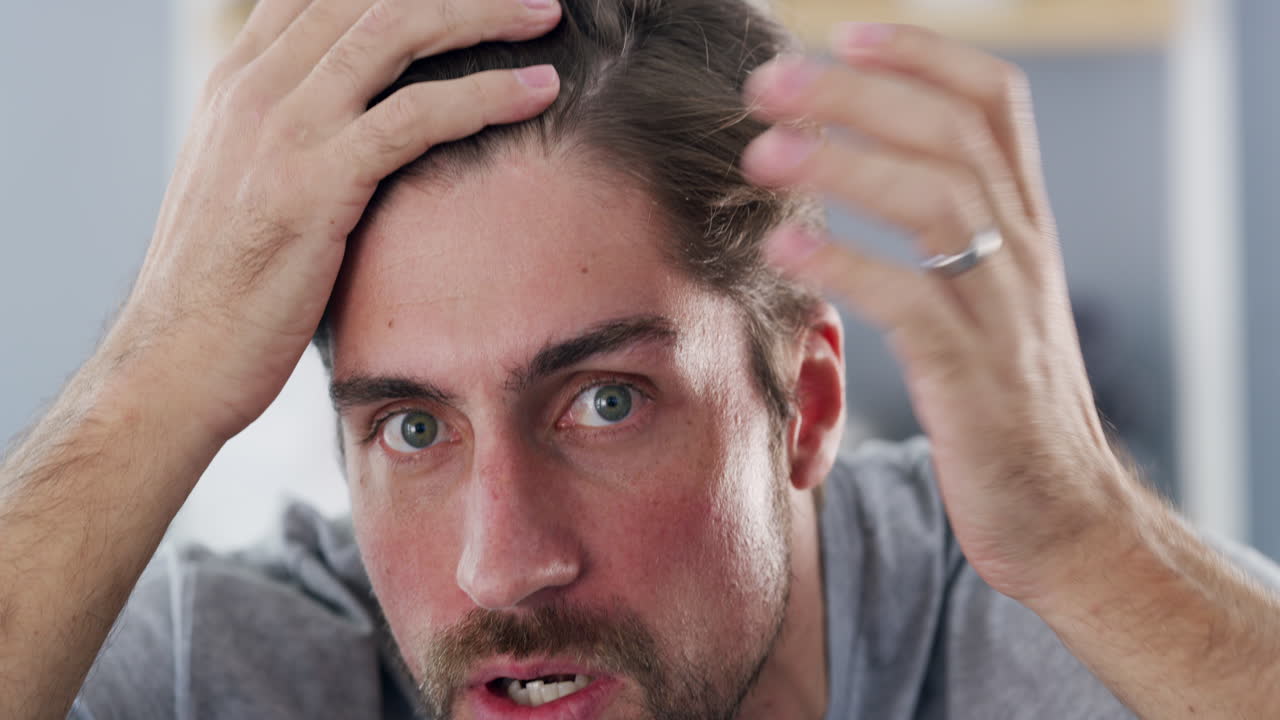 제 머리카락이 정말 물러나기 시작했나요?