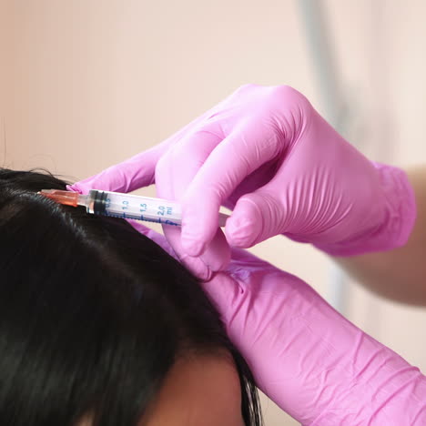 patient getting head injections. concept of hair loss. cosmetological clinic