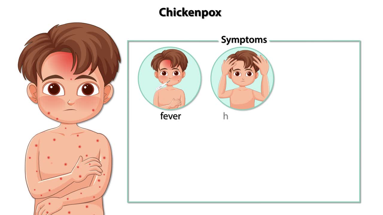 Step-by-step animation illustrating chickenpox symptoms in a cartoon boy with clear labeled visuals