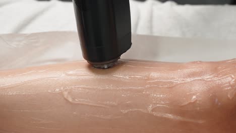 close-up of laser hair removal device on a woman's leg covered with gel during the procedure