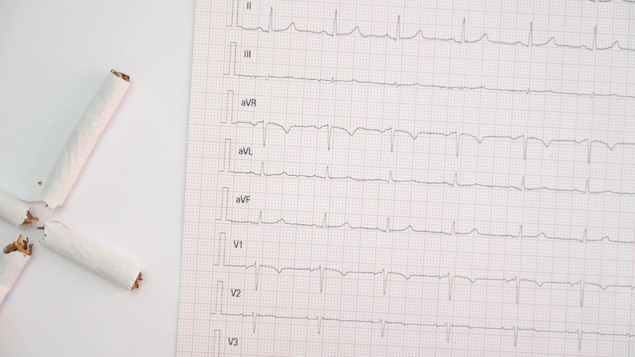 Sigarette rotte e un elettrocardiogramma che rappresentano i rischi per la salute del fumo su sfondo bianco.