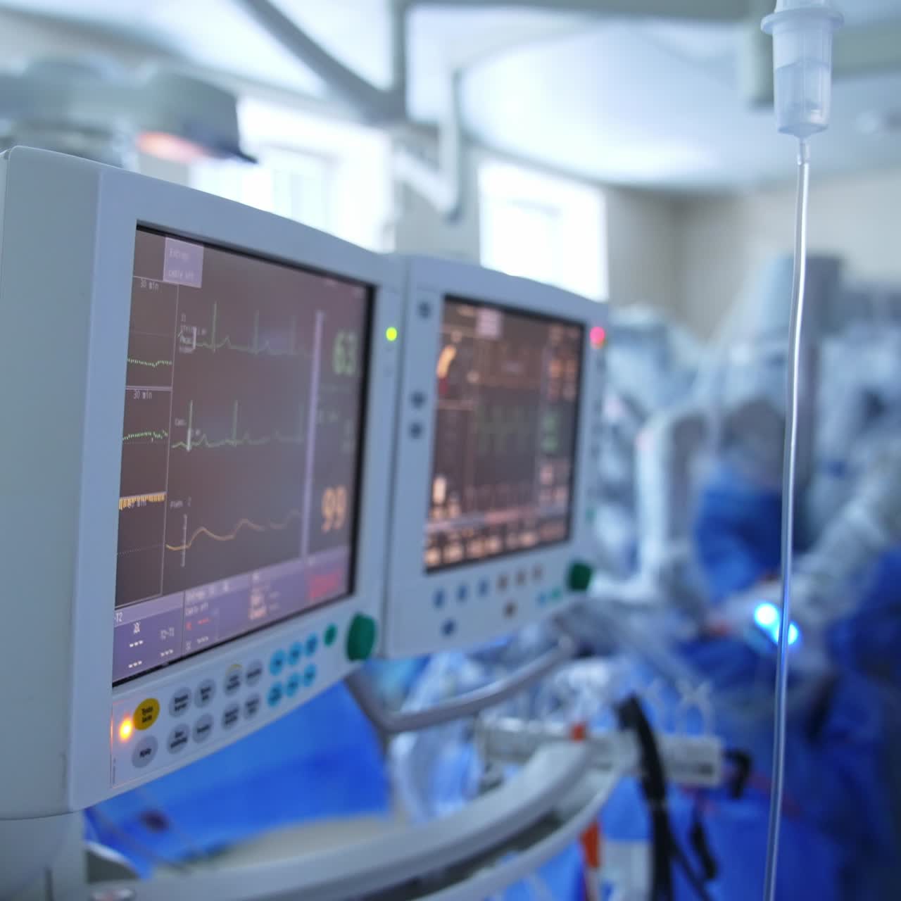 Due schermi accesi in una sala operatoria moderna. Monitor neri che mostrano i segni vitali di un paziente operato. Chirurghi che lavorano sfocati sullo sfondo