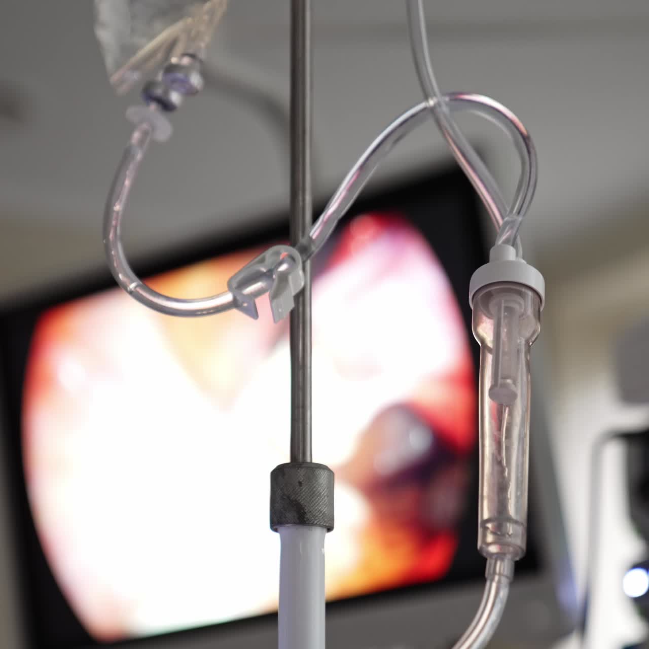 Medicine dripping inside the drop counter. Low angle view. Screen showing surgery work at backdrop in blur