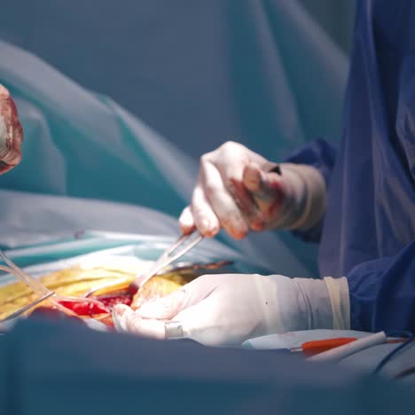 surgeon at work in operating room