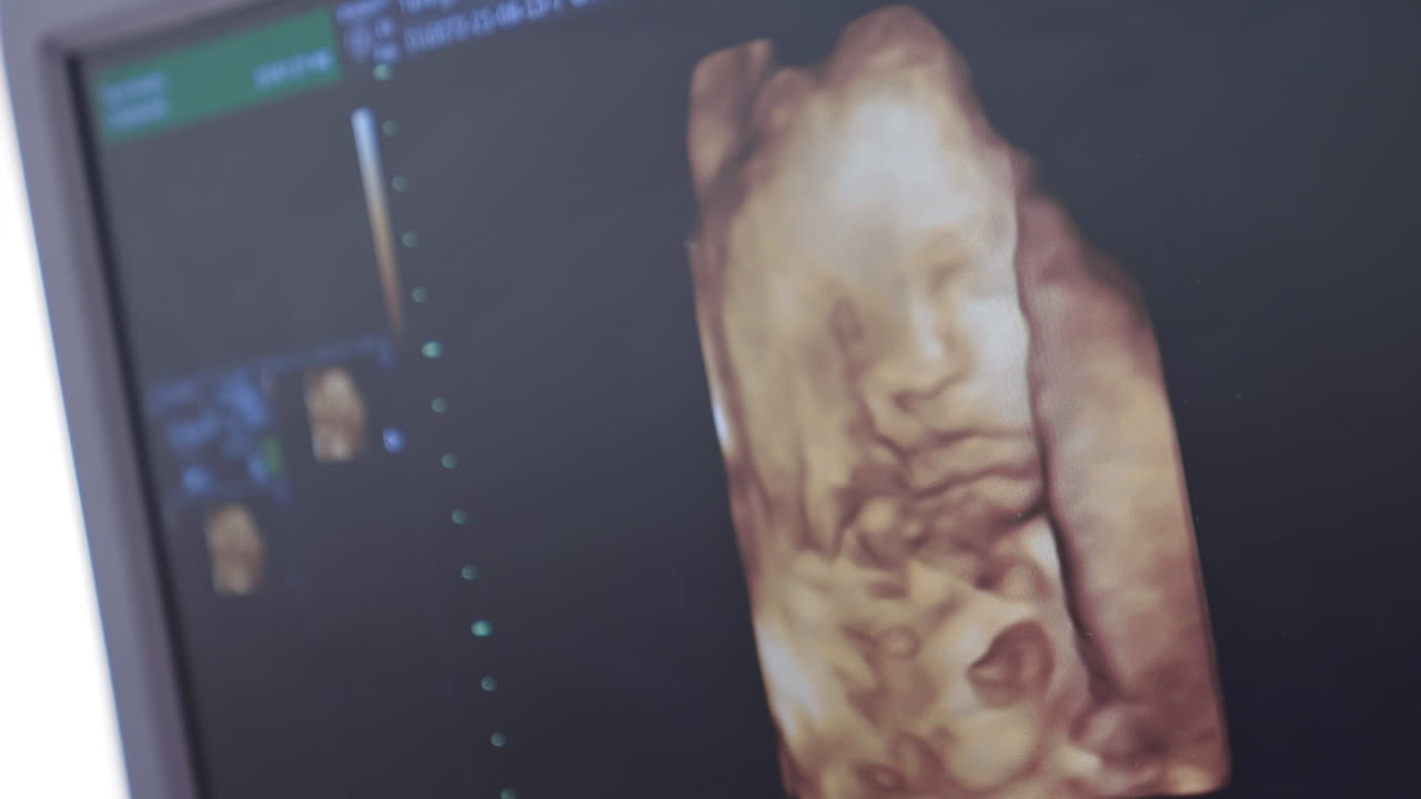 Ecografia fetale nell'utero materno. Concetto di gravidanza e assistenza sanitaria. Screening prenatale.