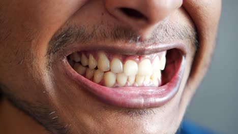 joven montado abierto comprobando sus dientes