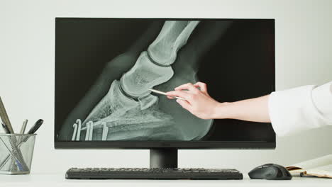 x-ray of a leg or foot