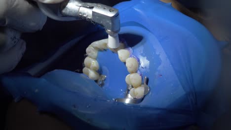 the work of a dental hygienist with a patient