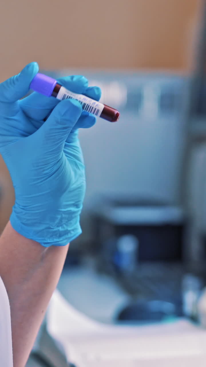 Laboratory worker holds a vial and mixes it by hand in hospital. Technician woman works with blood samples while standing close to the automated machine in clinic. Close-up. Vertical video