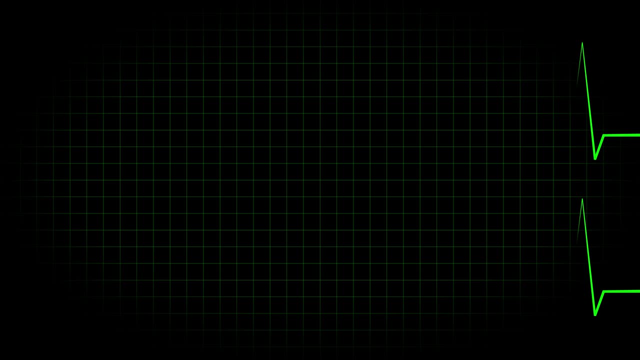 전기 심장 기록 오실로스코프 파동 형태 애니메이션 모션 그래픽