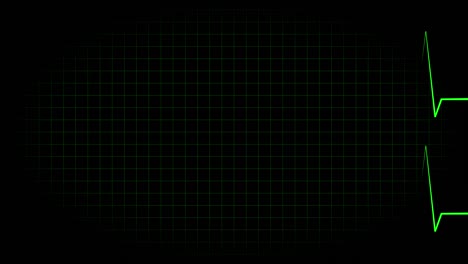 electrocardiograma osciloscopio forma de onda animación gráficos de movimiento