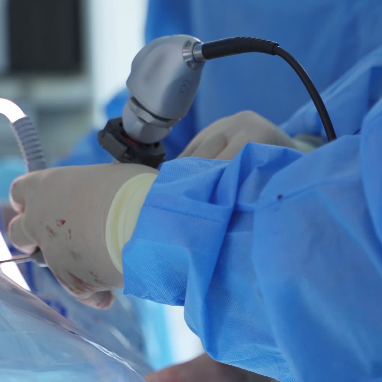 Surgery On Patient In Hospital. Close up of professional surgeons performing surgery on patient in the hospital