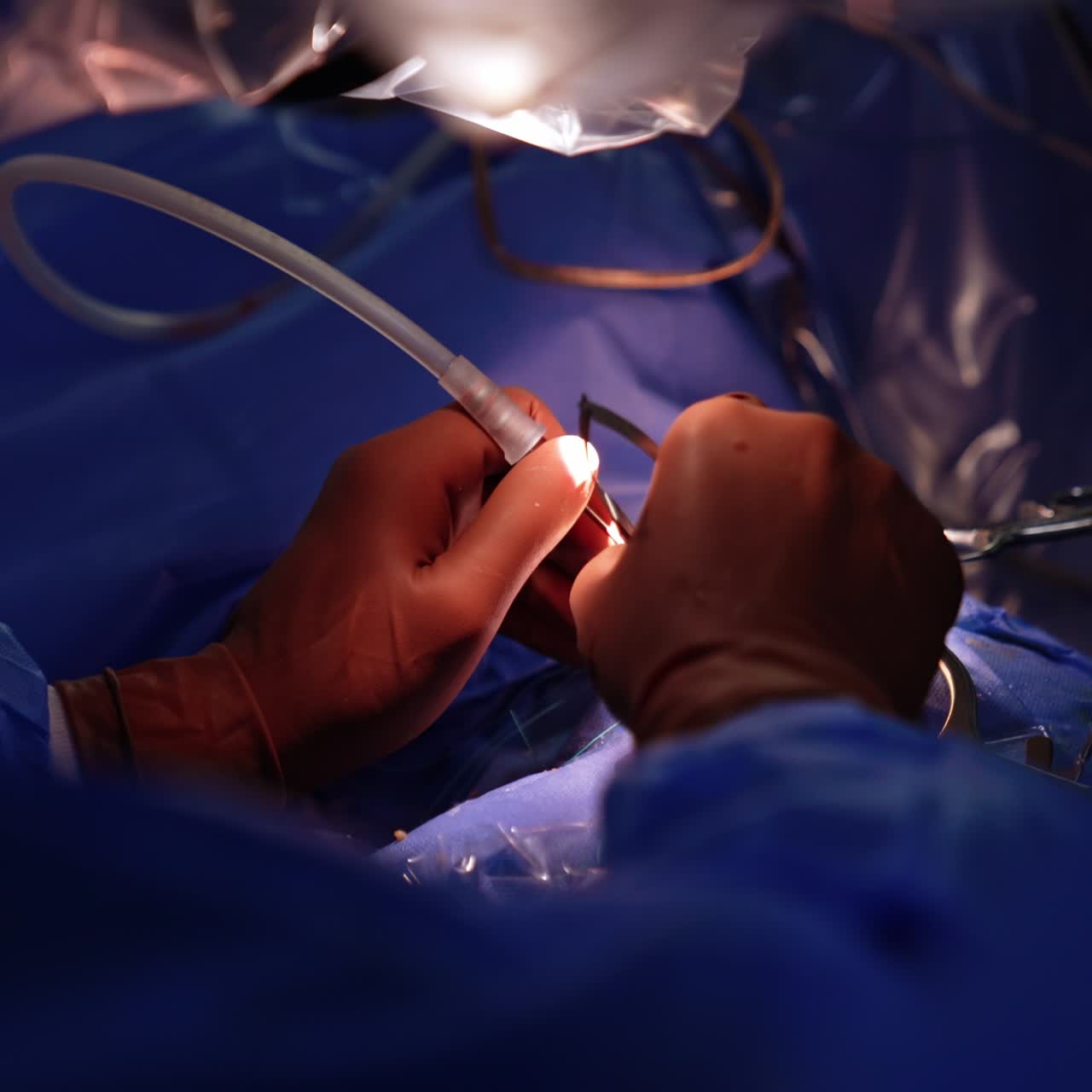 Doctor's hands in latex brown glove use the device tools. Microscope covered with plastic is above the operational spot. Close up