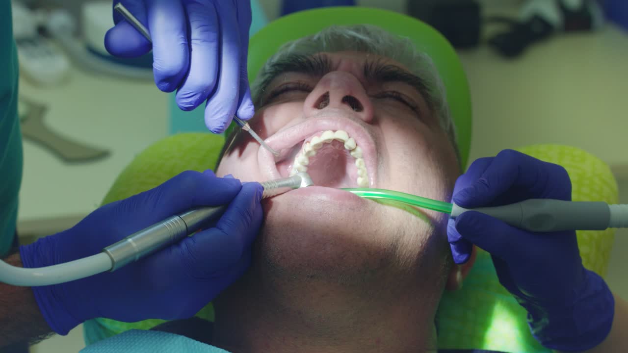 Dentist curing male patient in the stomatology. Close up dentist hands working