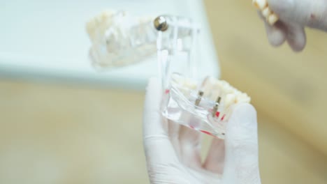demonstration of false teeth of implants on the layout of the jaw. dentist in white rubber gloves and dentures