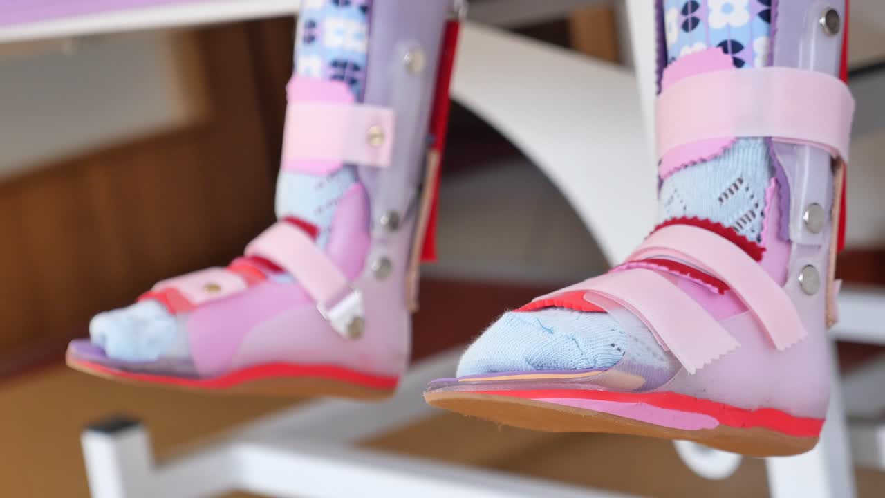 Close-up of a foot in a cast