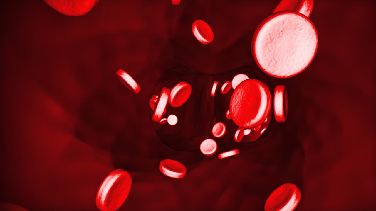 трехмерное уничтожение крови, протекающей по венам