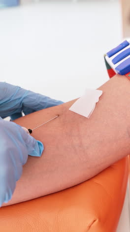 patient waiting for blood collection. in modern clinic doctor preparing the patient to take blood taste. vertical video