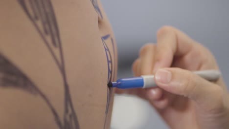 plastic surgeon delicately marking areas with a pen for aesthetic interventions, demonstrating meticulous planning for precise cosmetic procedures