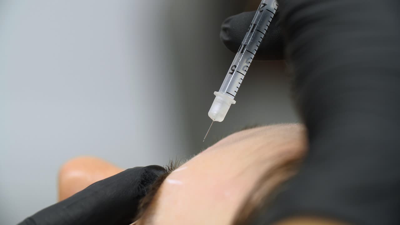 Botox injection by a beautician with a syringe into a woman's forehead. Close up.