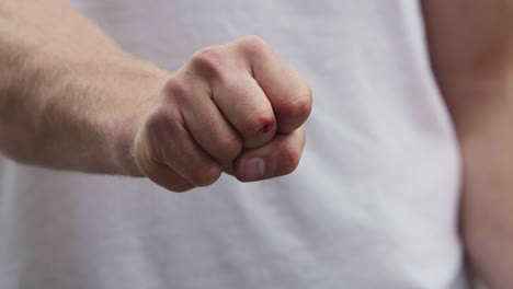 a guy showing his fist with a small wound on the fingers