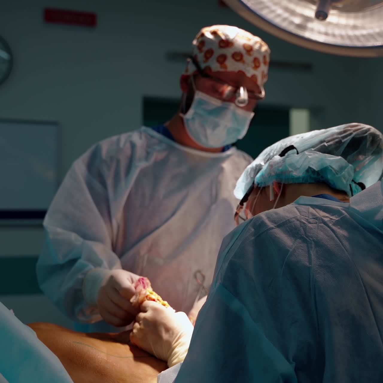 Plastic surgeon performs an operation for abdominoplasty with a transfer of the navel