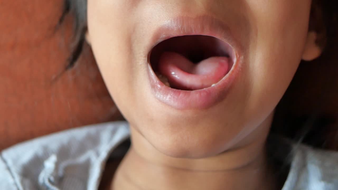 niño con la boca abierta