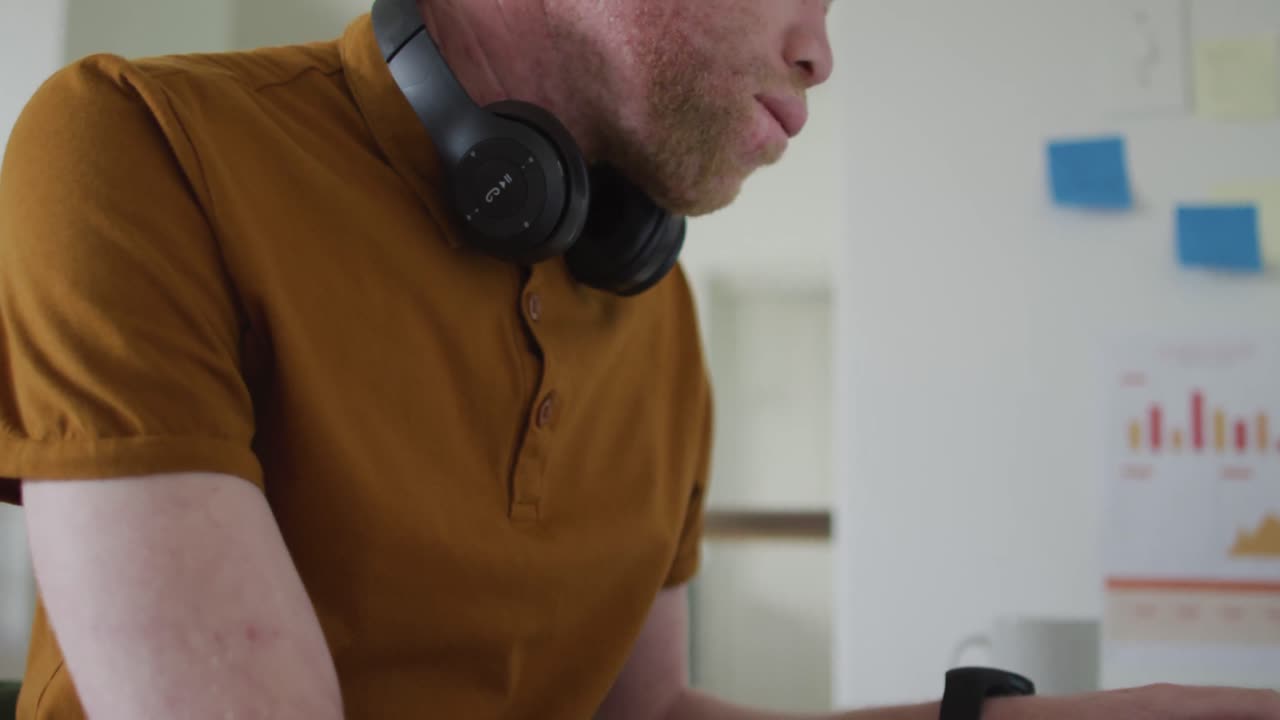 hombre albino afroamericano con rastas trabajando en la computadora portátil