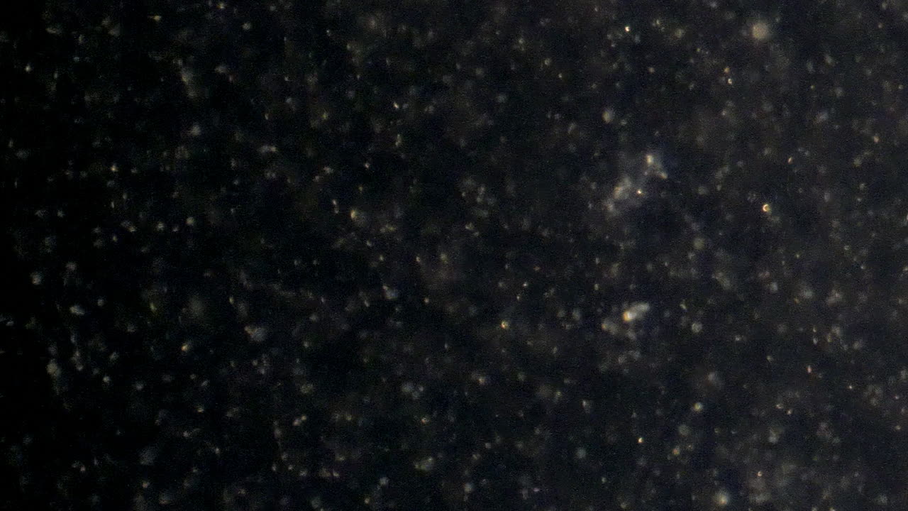 저배율에서 인간 정자 세포를 가로지르는 팬