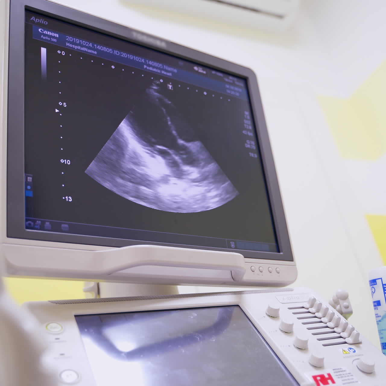 Panning shot of modern ultrasound machine. Screen of ultrasound machine for diagnostics in healthcare at the medical centre.